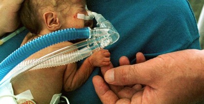 800px-Premature_infant_CPAP