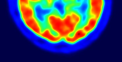 PET-image