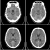 Computed_tomography_of_human_brain_-_large