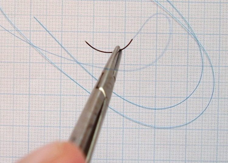 [Physician Comment] Suture closure superior to staples after cesarean delivery