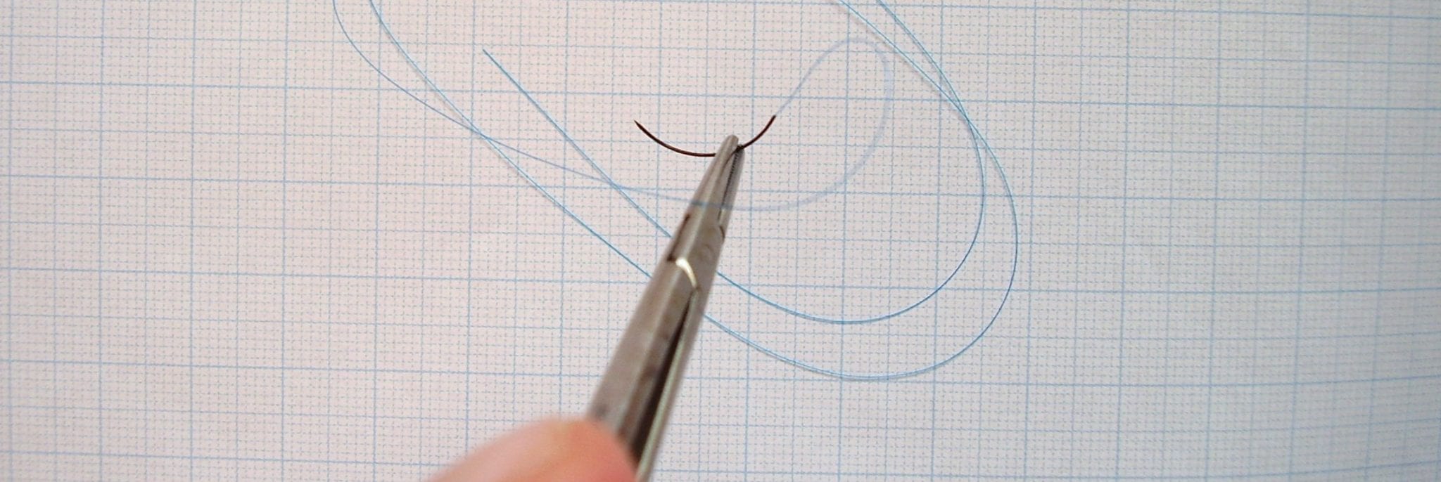 [Physician Comment] Suture closure superior to staples after cesarean