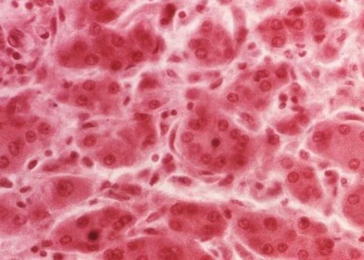 microRNA inhibitor shows promise in the treatment of Hepatitis C