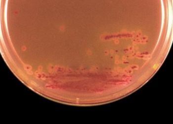 Carbapenem resistance in Enterobacteriaceae nearly quadrupled in the last decade, new study finds
