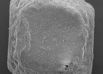 Salt intake linked with autoimmune disease