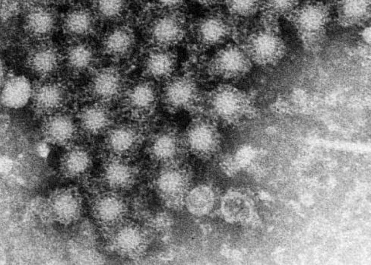 Hep B reactivation common after liver resection for HBV-related hepatocellular carcinoma