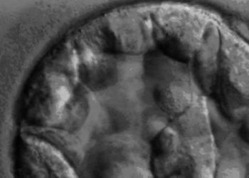 New approaches effective in screening embryos for diseases