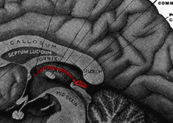 Low birth weight children show neurobehavioral impairments