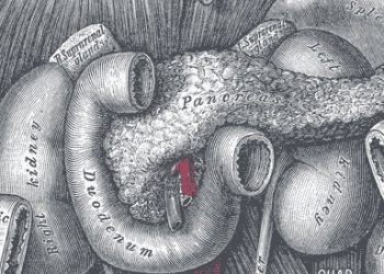 Artificial pancreas lowers the risk of overnight hypoglycemia in children