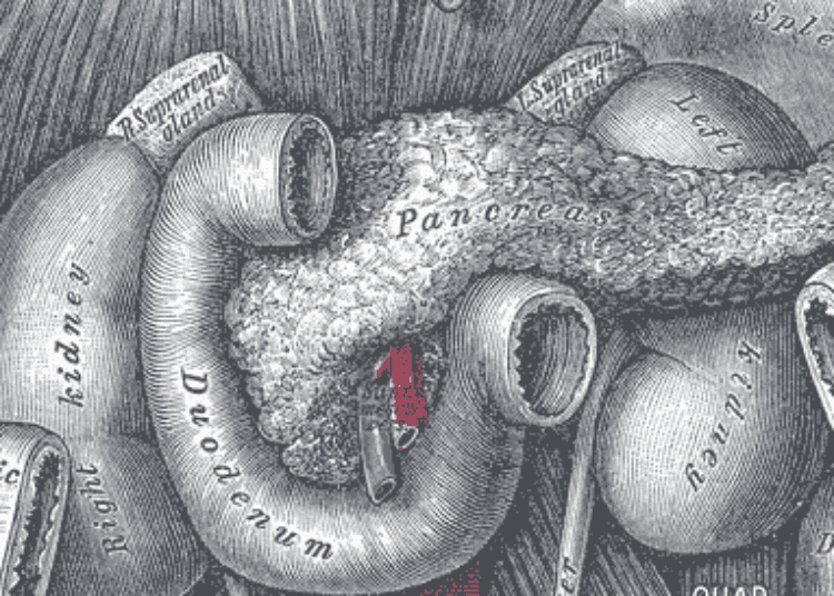Artificial pancreas lowers the risk of overnight hypoglycemia in children