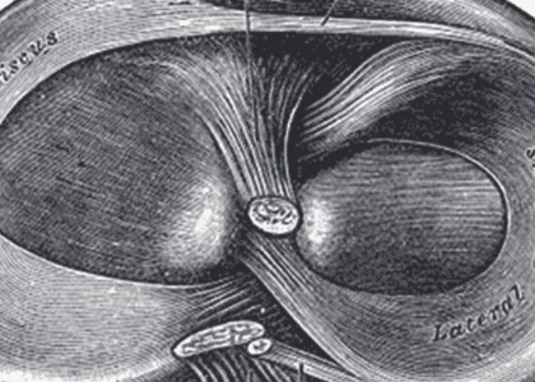 Physical therapy equal to surgery for symptomatic meniscal tears