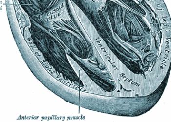 Regional wall thinning in CAD may be reversible