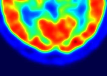 Childhood ADHD associated with increased risk of suicide [Physician Comment]