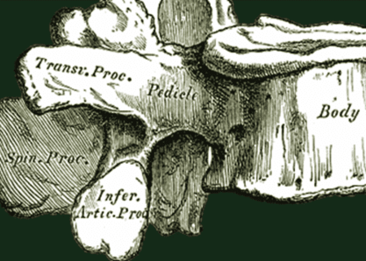 Maternal factors increase odds of congenital vertebral malformations by 6x