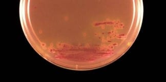 Gut microbes implicated in stroke and heart attacks: new dietary link