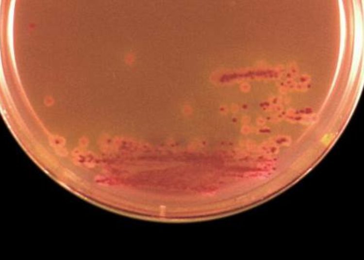 Gut microbes implicated in stroke and heart attacks: new dietary link