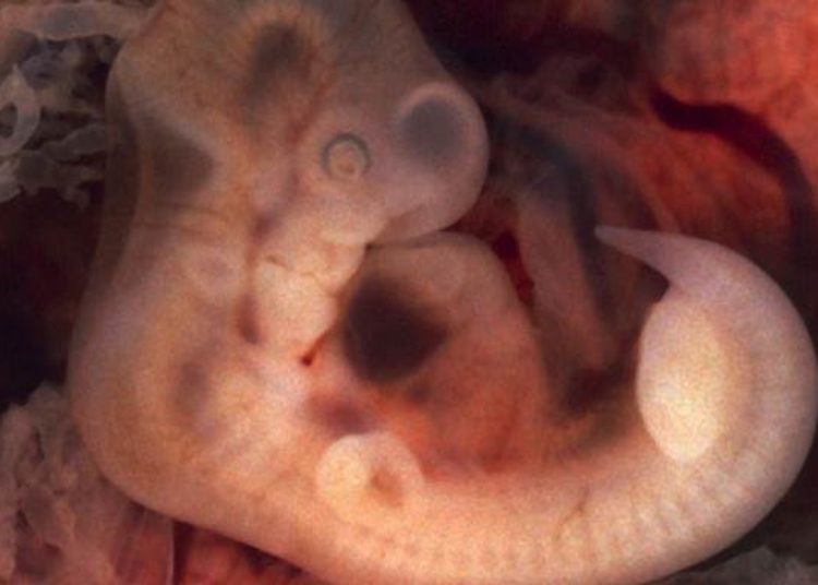 Transvaginal ultrasound is the best diagnostic method for ectopic pregnancy