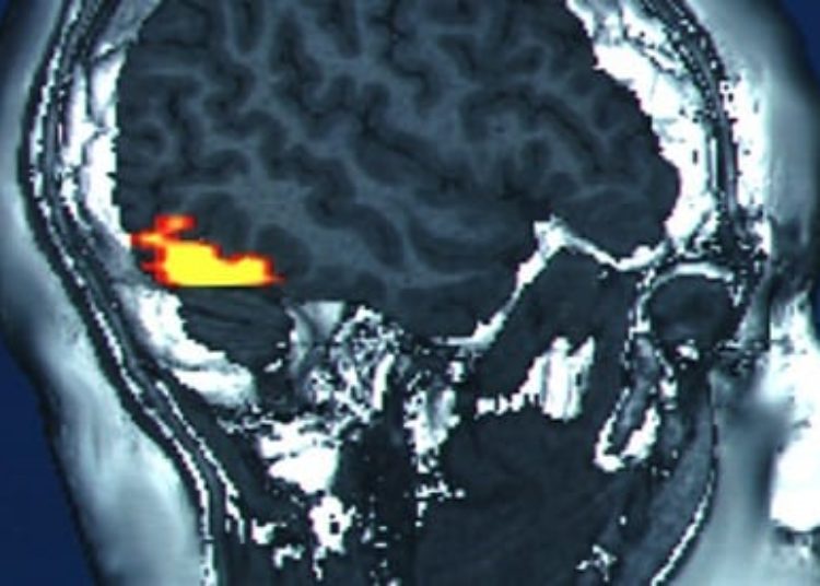 Functional MRI map for physical pain identified