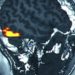 Functional MRI map for physical pain identified