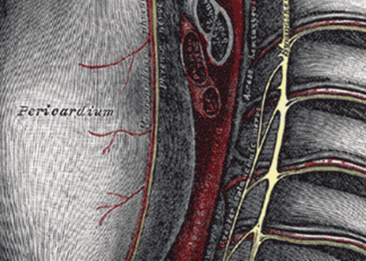Drainage for hemopericardium is safe and reduces hospital stay