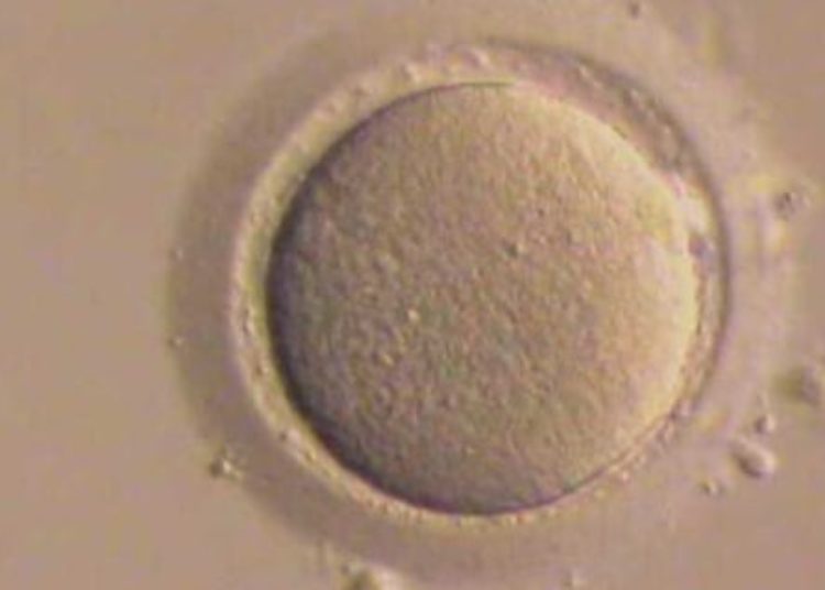 Significant racial disparities in preterm births in infants conceived by IVF