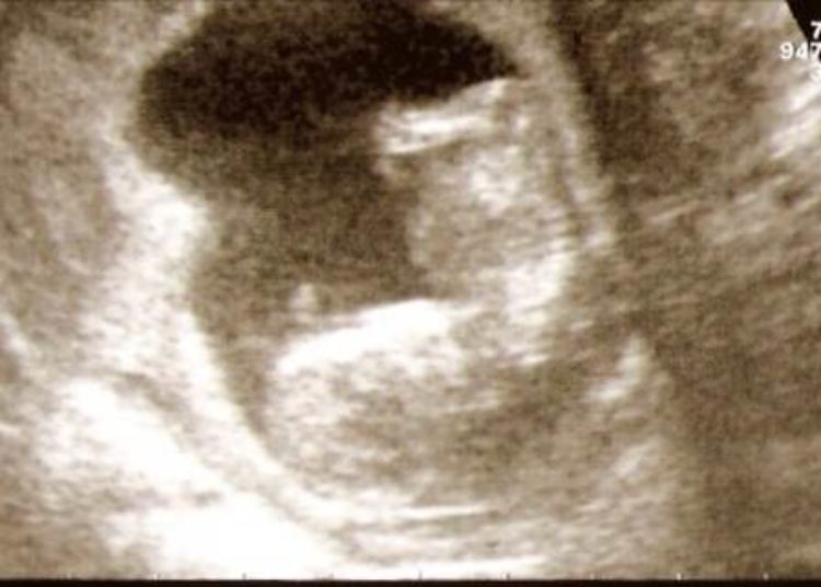 Light drinking during pregnancy may be safe