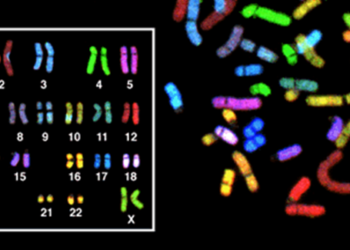 Chromosomal analysis not cost-effective in evaluation of recurrent miscarriage