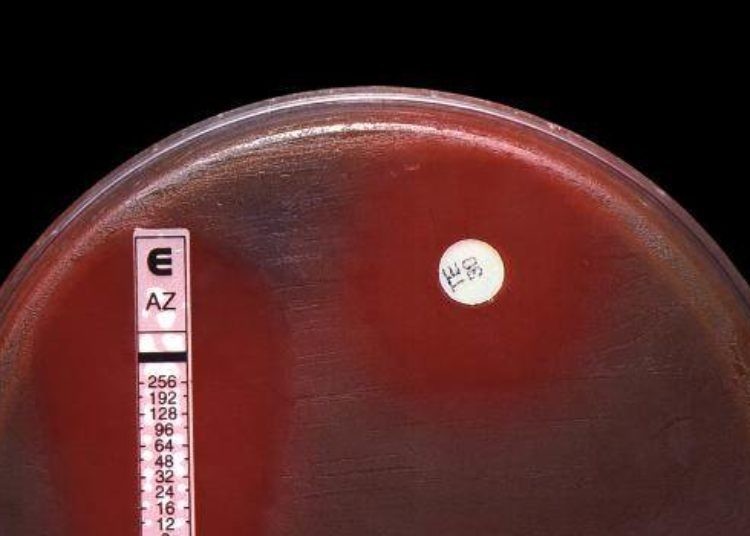 Azithromycin is not associated with increased cardiovascular death in low-risk groups