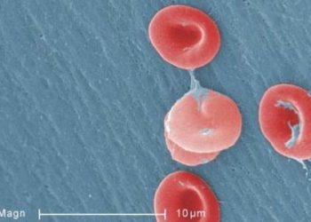 Lower target oxygen saturation in extremely preterm infants appears safe