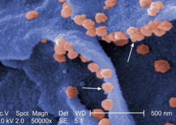 Novel Mid-East coronavirus (MERS-CoV): First detailed report