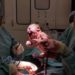 Obtaining consent for c-section during labor may be suboptimal