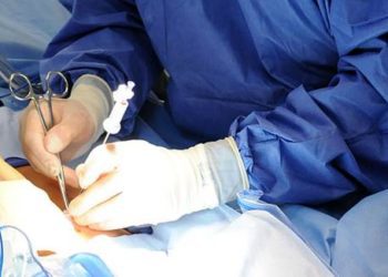 Sleeve gastrectomy surgery linked to more weight loss than lap-band