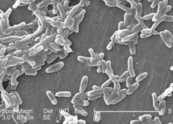 Early risk factor for progression of cystic fibrosis identified