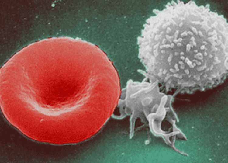 Prophylactic platelet transfusions prevent bleeding in hematologic cancers