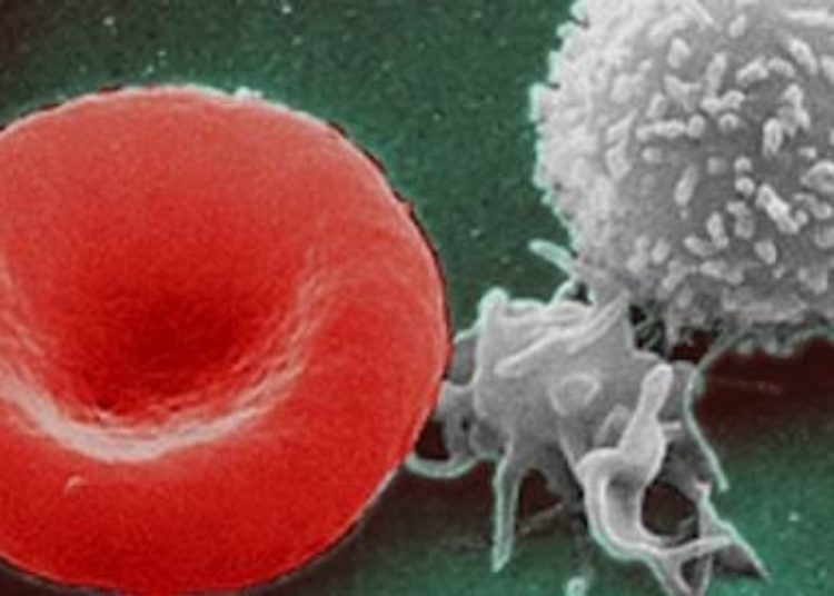 Prophylactic platelet transfusions prevent bleeding in hematologic cancers