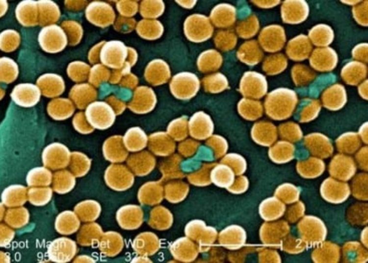 Universal decolonization effective at reducing MRSA