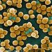 Universal decolonization effective at reducing MRSA