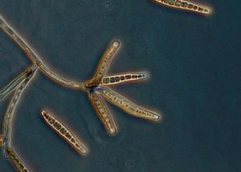 MRI screening for fungal infection from methylprednisone injections