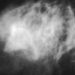 Intake of fish fatty acids associated with lower risk of breast cancer