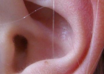 Otoacoustic emissions may be an effective objective hearing test