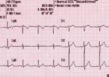 Preterm delivery associated with long-term maternal cardiovascular risk