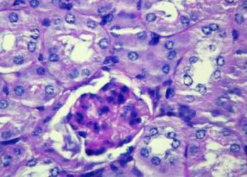 Urinary mRNA profiling accurately diagnoses rejection in kidney allografts