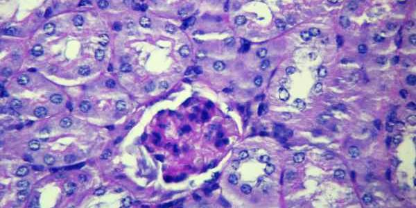 Glomerulus_pas