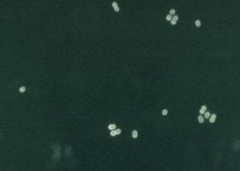 Pneumococcal vaccine associated with a decrease in pneumonia hospitalizations