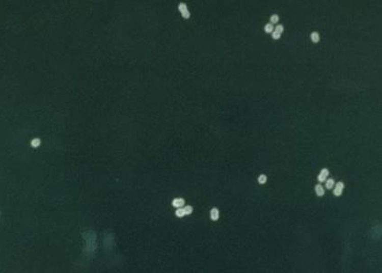 Pneumococcal vaccine associated with a decrease in pneumonia hospitalizations