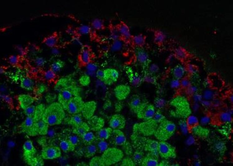 Pancreatic islet autotransplantation a potential treatment for malignant disease