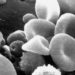 New genetic link in pulmonary arterial hypertension holds therapeutic promise