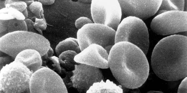SEM_blood_cells