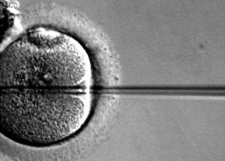 Mental retardation associated with IVF treatment