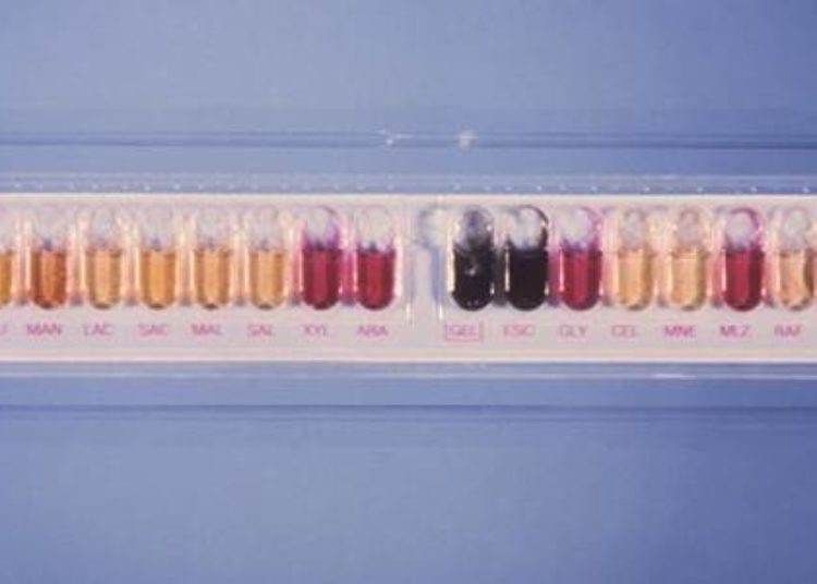 Cord colitis syndrome found to have a novel infectious etiology