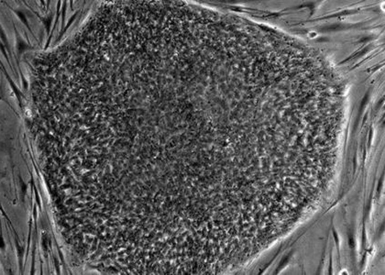 A new biomarker for therapy-resistant graft-versus-host disease and death